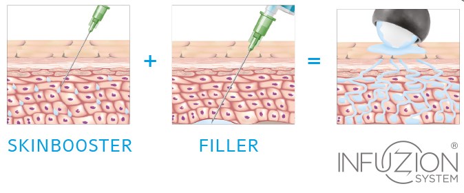 Example image