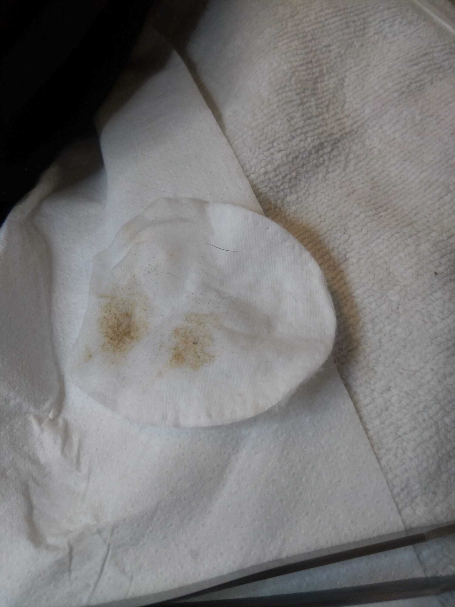 Cotton disc layer of dead skin cells i.c.w. shed pigment cells after facial skin removal.

Wattenschijf laagje dode huidcellen icm afgestoten pigmentcellen na het afnemen van de gezichtshuid.