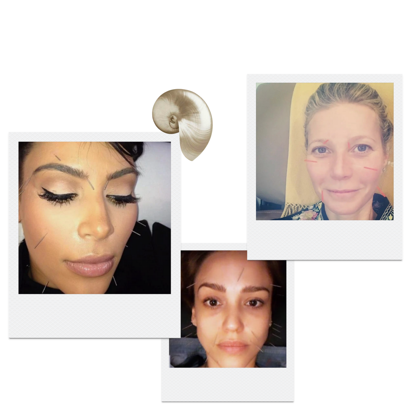 Cosmetische acupunctuur: natuurlijke huidverjonging en versteviging, populair bij beroemdheden zoals Gwyneth Paltrow, Kim Kardashian en Jessica Alba. Nu in Eindhoven