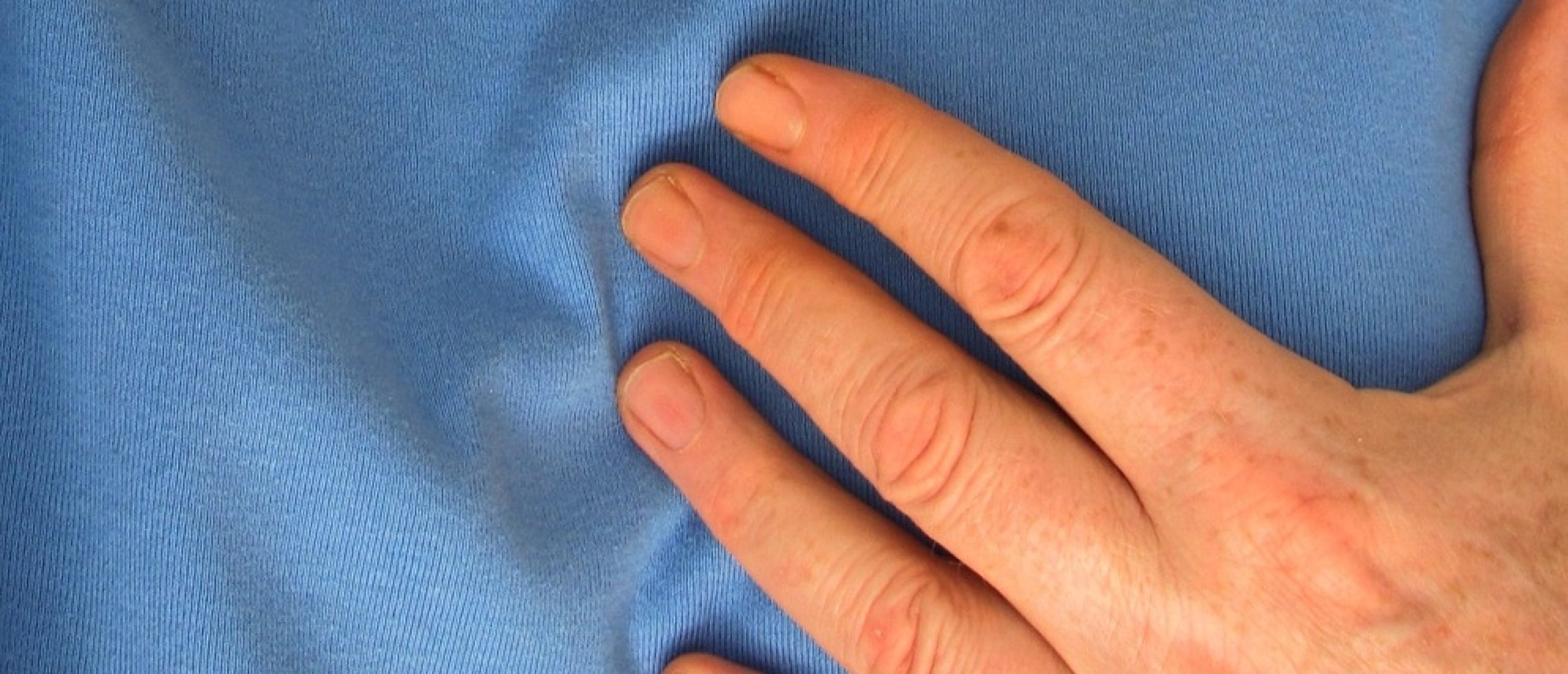 Overgewicht en hartrisico