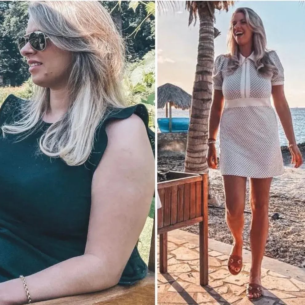 Before and After