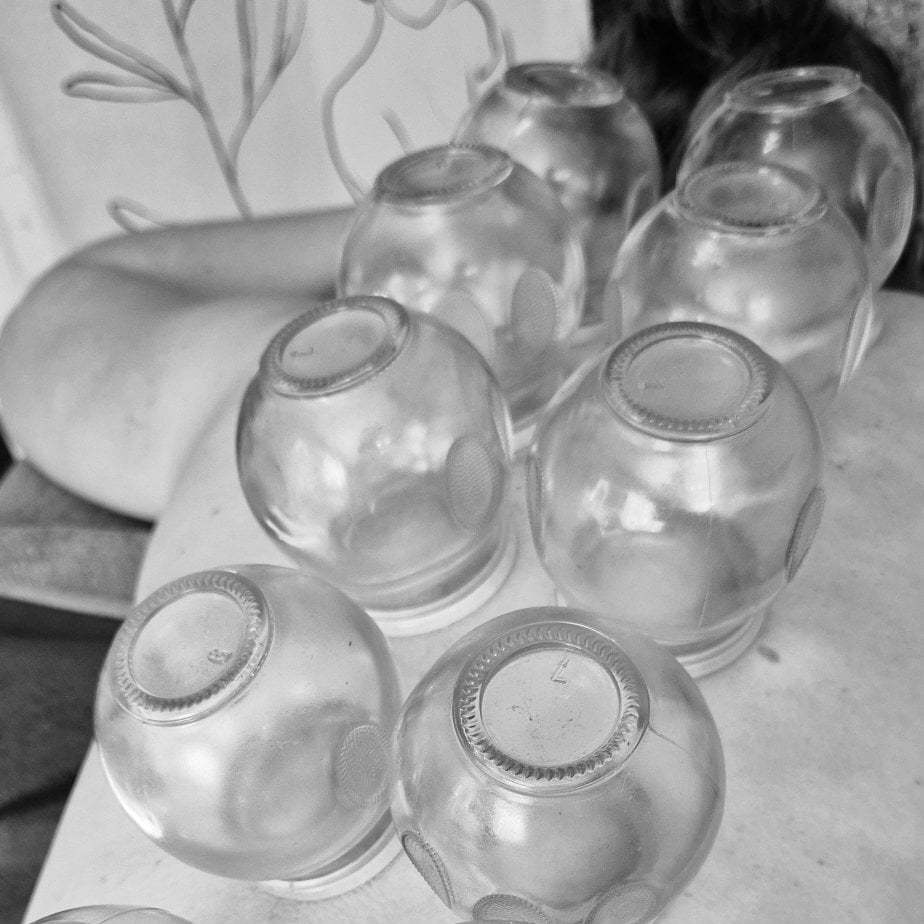 Vuurcupping - Cele Brate Life