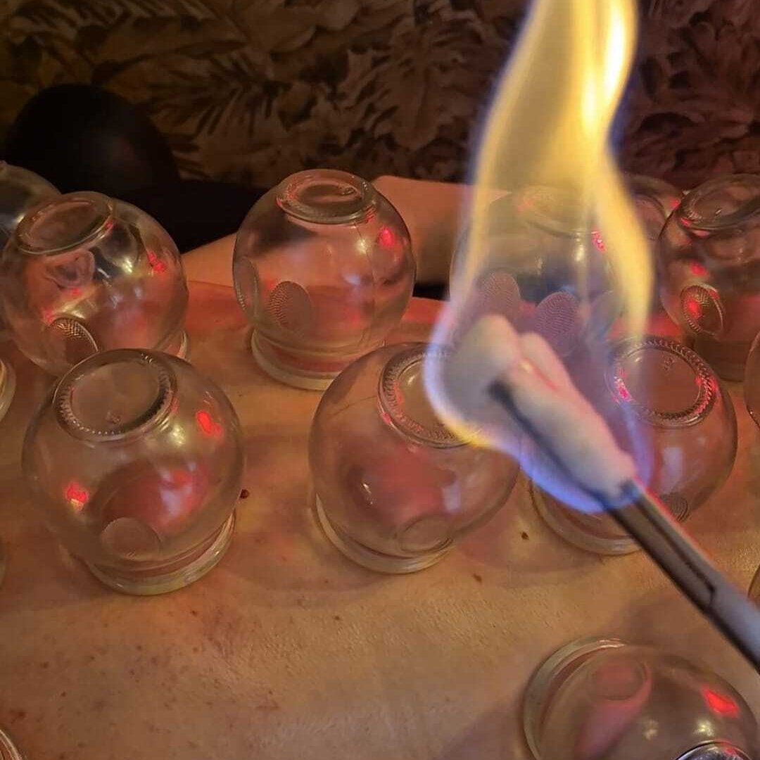 Vuurcupping - Cele Brate Life